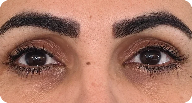 After treatment
