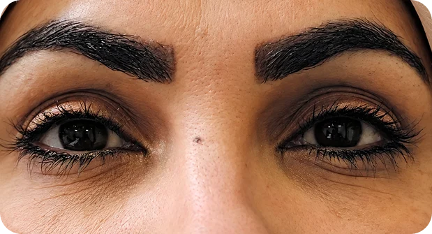 Before treatment
