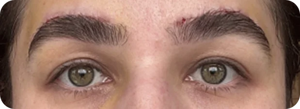 After treatment